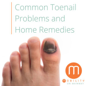 Common Toenail Problems and Home Remedies
