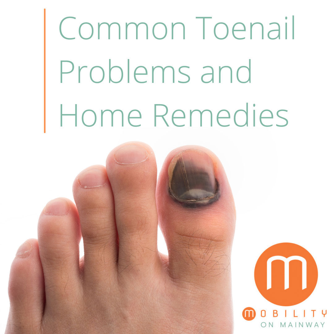 Effective Ways to Treat Toenail Fungal Infection at Home - Miduty