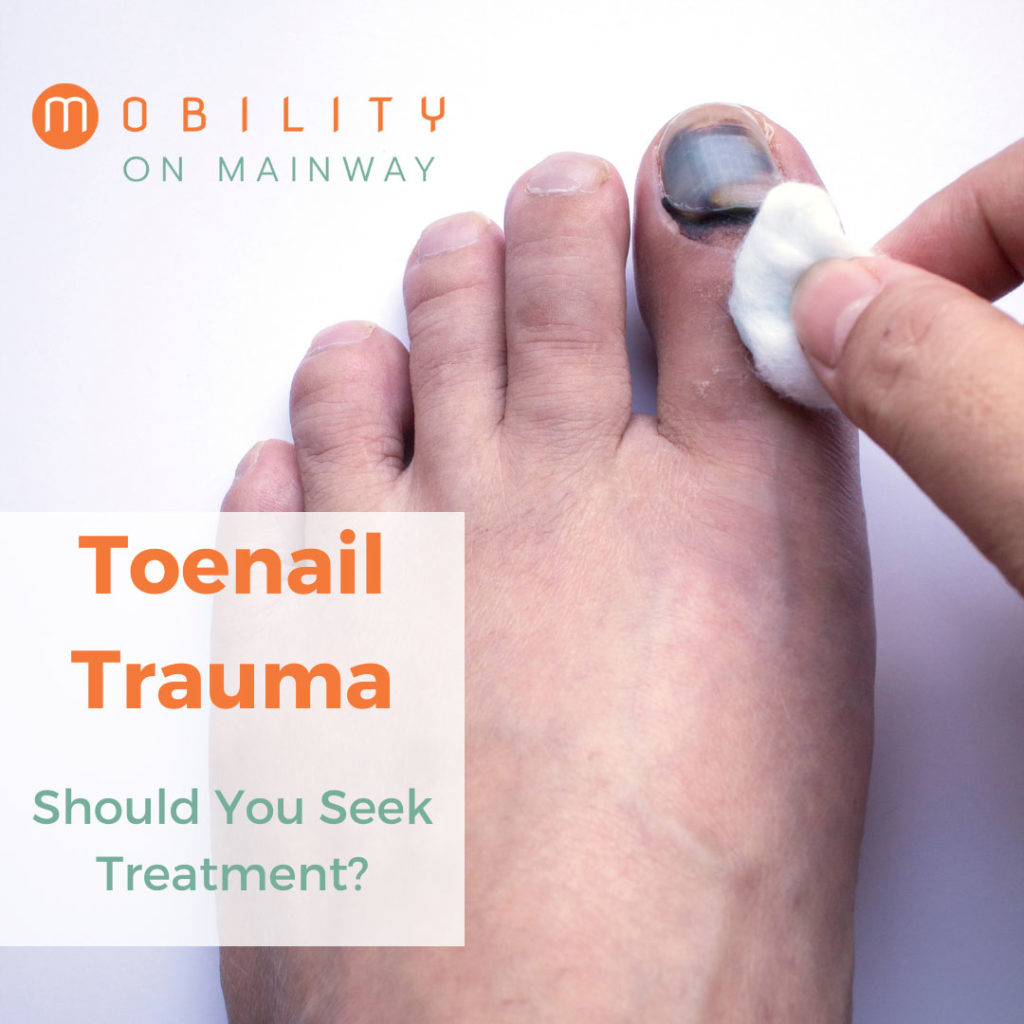 Toenail Trauma: Should You Seek Treatment?