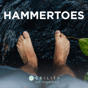 Learn more about: Footwear for Hammertoes, Treating Hammertoes, and Exercises for Hammertoes.